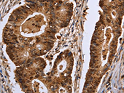 EXTL3 Antibody