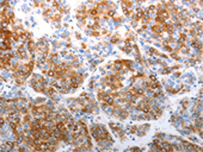 CDH5 Antibody