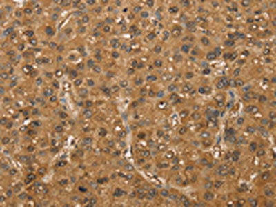 SETD2 Antibody
