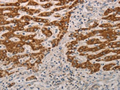AIFM1 Antibody