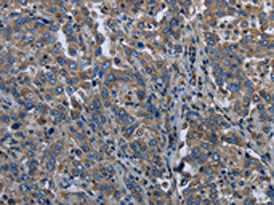 MAPKAPK2 Antibody