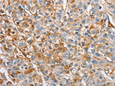 IKBKG Antibody