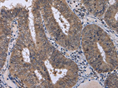 CDK5 Antibody