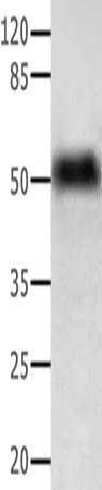 ACPP Antibody