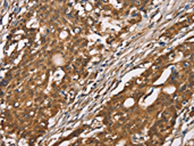 DICER1 Antibody