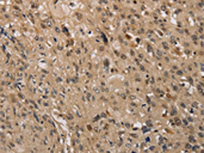 KDM4A Antibody
