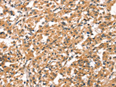 CYP46A1 Antibody