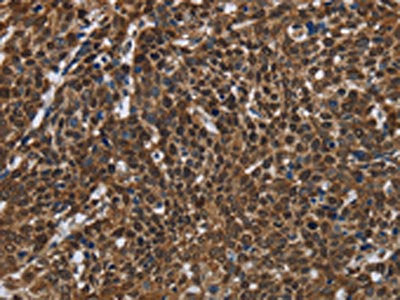 FASTKD2 Antibody