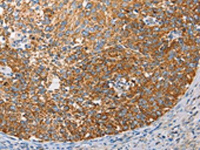 APOBEC3G Antibody