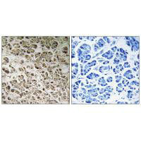 NDUFB1 Antibody