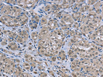 FAR2 Antibody