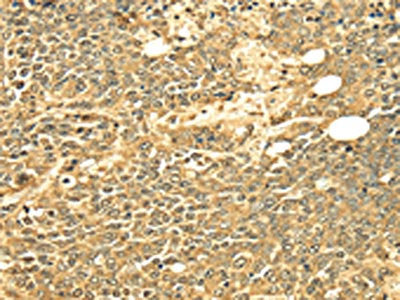 ECE2 Antibody