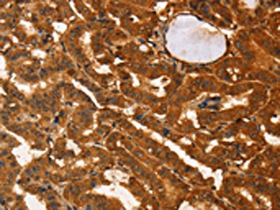 IKZF3 Antibody