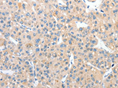 RPN1 Antibody