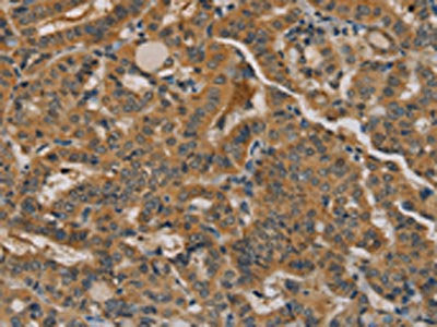 NANOS2 Antibody
