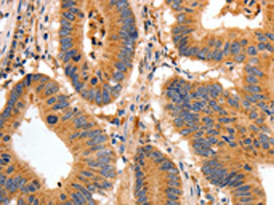 BAIAP2 Antibody