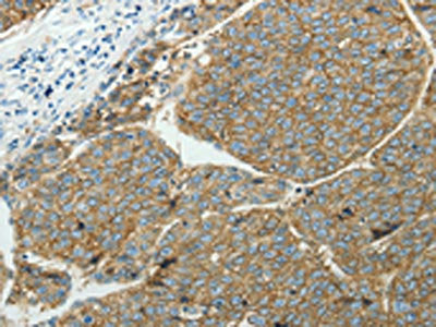 SLC16A1 Antibody