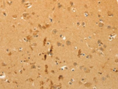 CFHR1 Antibody
