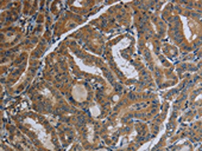 FAAH Antibody