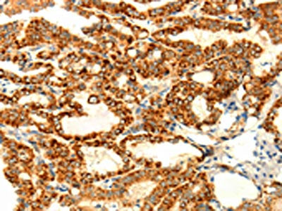 DIABLO Antibody