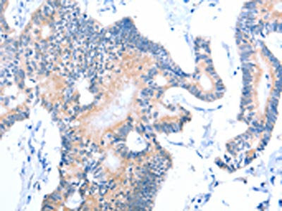 ACAD11 Antibody