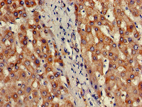 PRDM2 Antibody