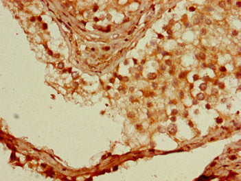 SSX1 Antibody