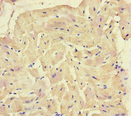 SQSTM1 Antibody