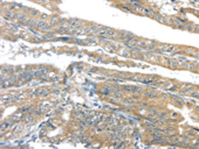 AKT2 Antibody