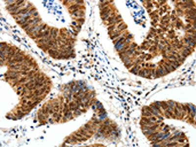 SP1 Antibody