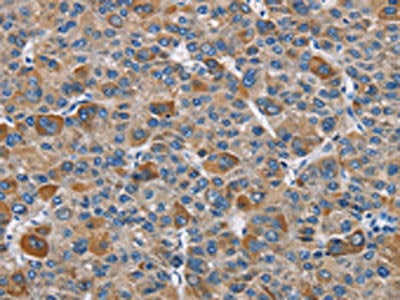 DNMT3A Antibody