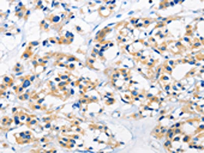 HK1 Antibody