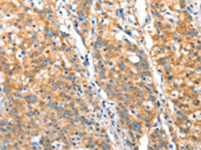ST14 Antibody