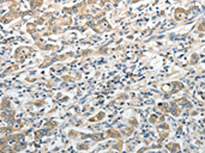 PRMT2 Antibody