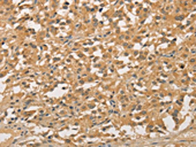 NFE2L1 Antibody