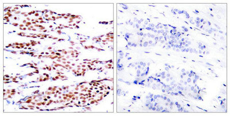 Phospho-JUNB (Ser79) Antibody