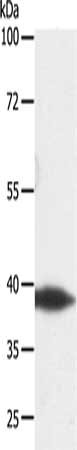 DTX3 Antibody