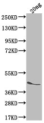 ICSA Antibody