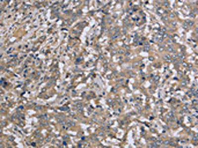 DTNB Antibody