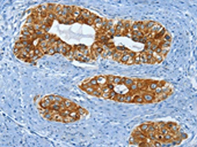 KRT81 Antibody