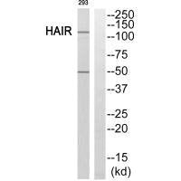 HR Antibody