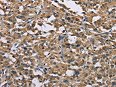 GAB1 Antibody