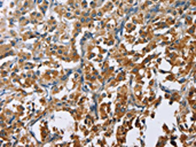 CARD9 Antibody