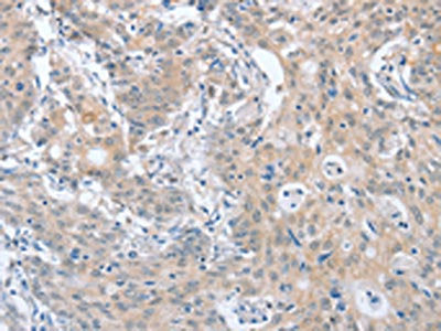 PAPSS1 Antibody
