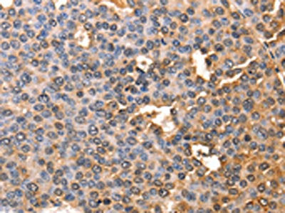 AFP Antibody