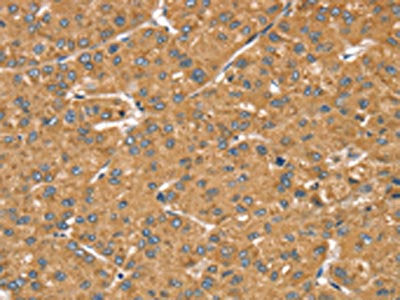 LMO4 Antibody