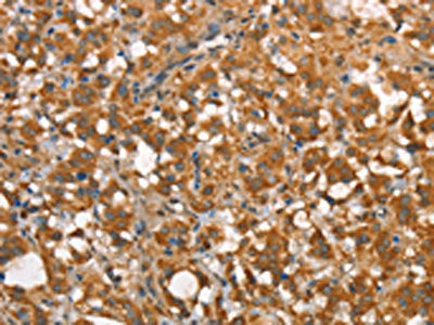 CALCRL Antibody