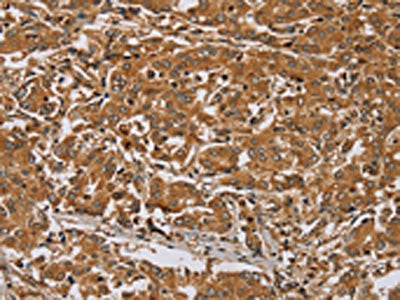 RAB8A Antibody