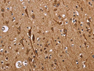 ETV7 Antibody