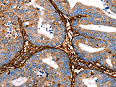 LGALS1 Antibody